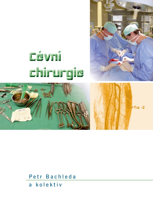 Cévní chirurgie