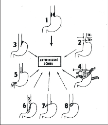 Obr. 5 - Jednotlivé složky antirefl exního mechanizmu GES