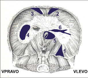 Obr. 1 – Bránice při pohledu z dutiny břišní. Schematické zobrazení anatomických lokalit a defektů, kde se tvoří kýly:  1. trigonum Bochdaleki vlevo či vpravo  2. fissura Larreyi vlevo  3. fissura Morgagni vpravo  4. dorsolaterální defekt v centrum tendineum vlevo či vpravo  5. rozšířený jícnový hiátus  6. traumatická ruptura v oblasti centrum tendineum