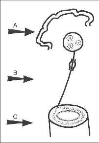 Obr. 1 – Schematické znázornění vagové inervace jícnu. Šipky ukazují možné primární poškození uplatňující se v etiopatogenezi vzniku onemocnění. A – centrální nervový systém, B – n. vagus, C – plexus myentericus a hladká svalovina jícnu