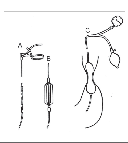 Obr. 9a, b, c – Historické dilatátory: A – schematické znázornění Starckova dilatátoru, B – rozevřené branže, C – pneumatický balonkový dilatátor