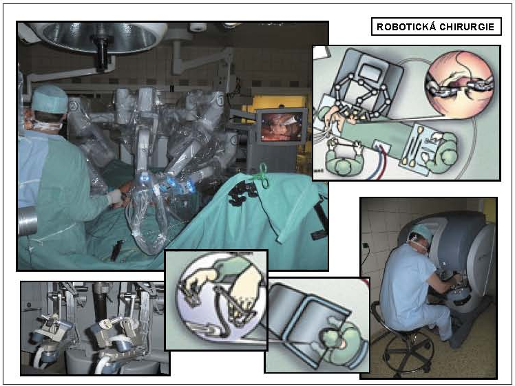 Obr. 3 – Robotická chirurgie