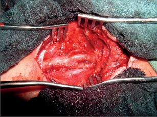 Primární sutura arterie