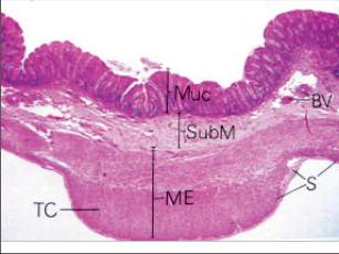 Obr. 23 – Histologický řez stěnou tlustého střeva (Muc – mukóza, SubM – submukóza, ME – muscularis externa, S – seróza, TC – tenia coli, BV – cévy)  ke změkčení stolice a Aesci