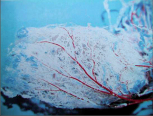 Obr. 93 – Odlitek cév hemoroidálního plexu