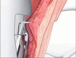 Obr. 115 – Opich hemoroidální arterie – anatomický řez